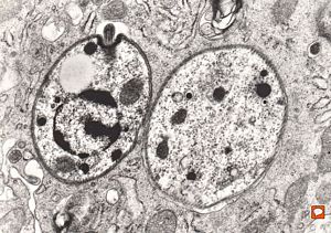 M, 28y. | leishmaniosis … skin of the cheek